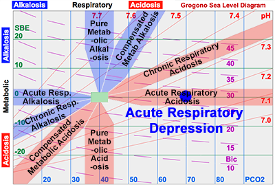 Acute Respiratory Depression