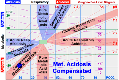 Metabolic Acidosis Compensated